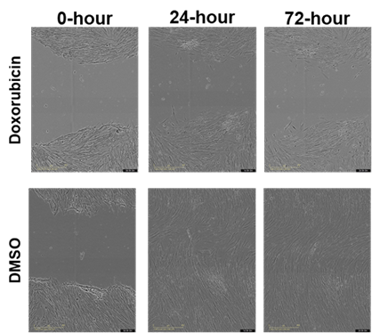 Senescence assay development