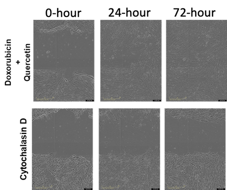 Senescence assay development