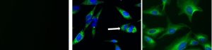 Autophagy assay development