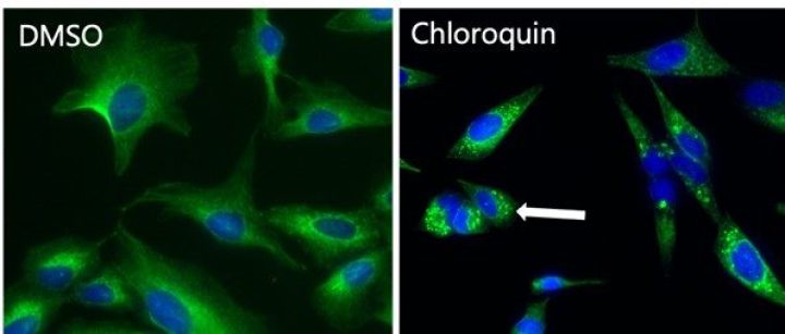 Autophagy assay development_High content imaging