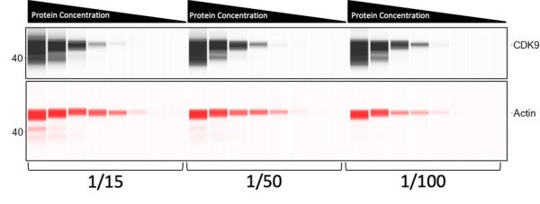western blotting_Pseudo image_CDK9 and Actin